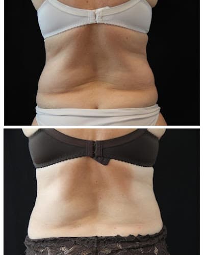 Dr Pierre Alain Mayeux Beauty Center Medical