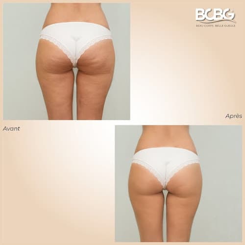 BCBG | Institut de Beauté Paris 15