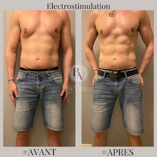 ByVinca Paris 14, Épilation Définitive, Cryolipolyse