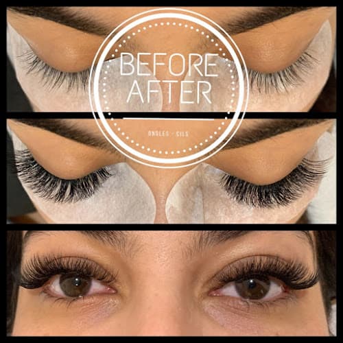 Before After - Institut de Beauté Strasbourg