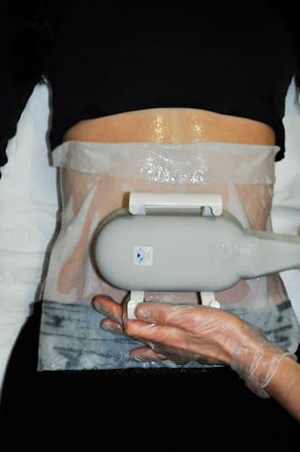 DermaPro Paris Ternes 17ème - Epilation Laser - Cryolipolyse - Hydrafacial