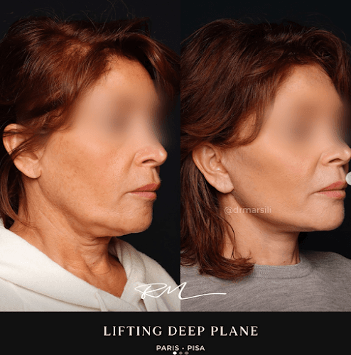 Docteur Riccardo Marsili : Chirurgien esthétique à Paris