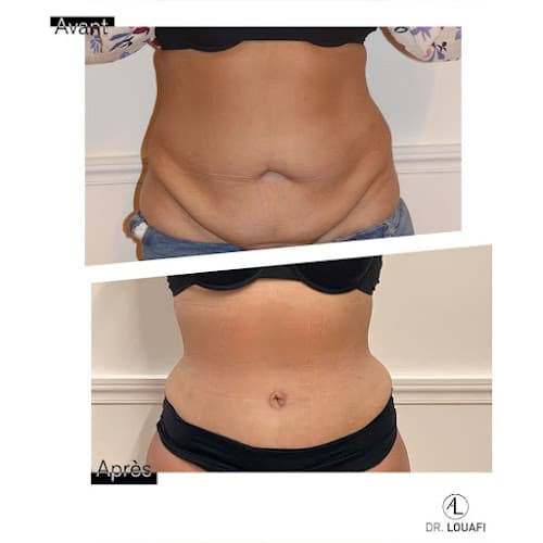 Dr. Adel Louafi - Chirurgien et médecin esthétique