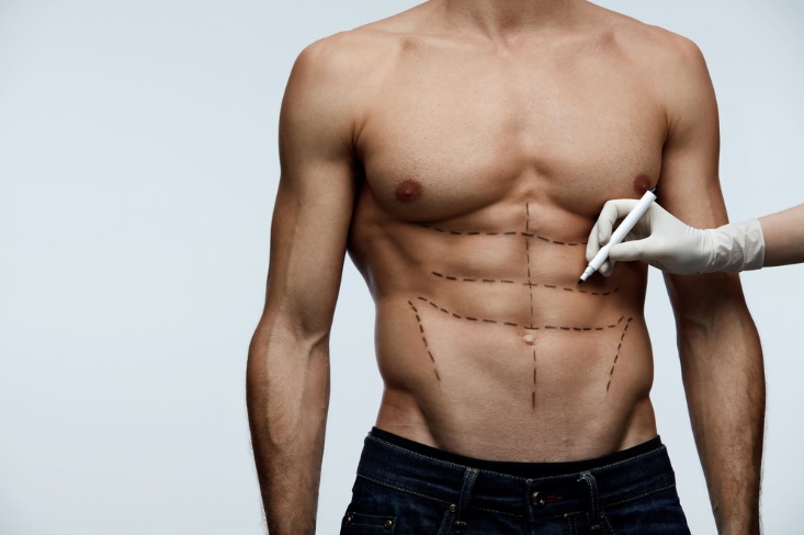 Chirurgie plastique : les opérations les plus populaires chez les hommes